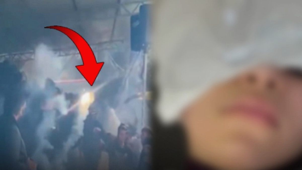 Tribünde maganda dehşeti: Meşale kız çocuğunun gözüne girdi!