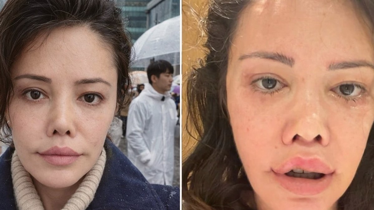 Kore’de yüz nakli olan Didem Ceran son halini paylaştı: ''Bebeksiliğim yapay zeka değil''
