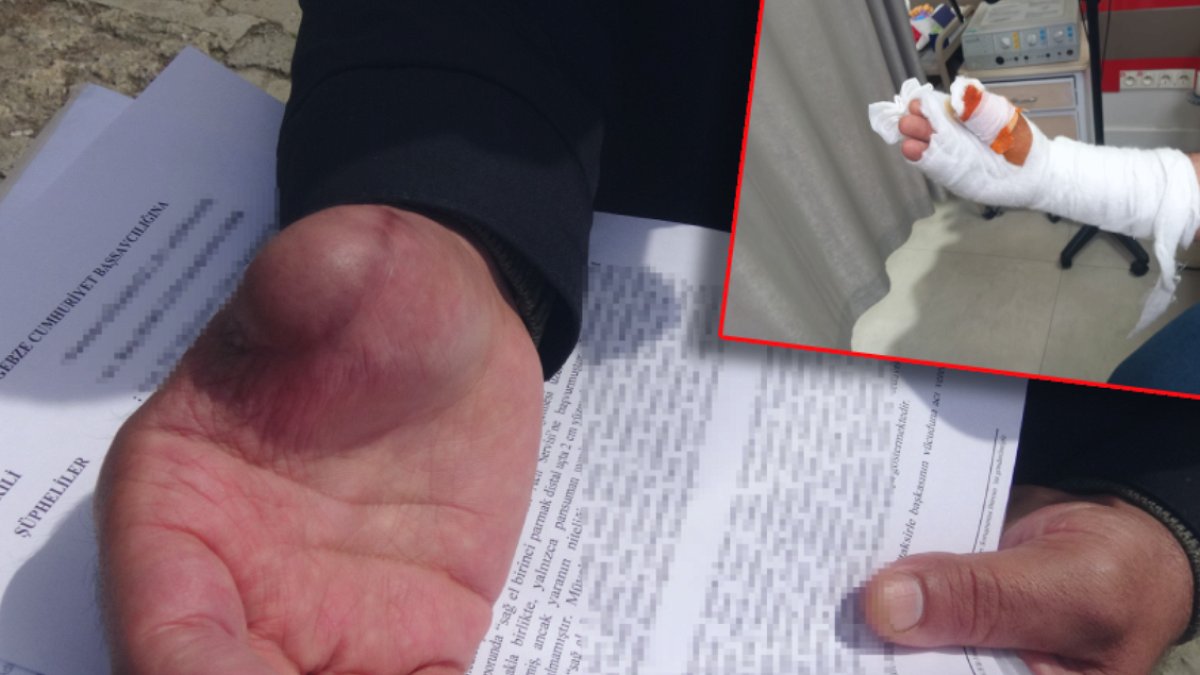 Bir kesikle hayatı karardı: 'Parmağım çürümeye başladı'