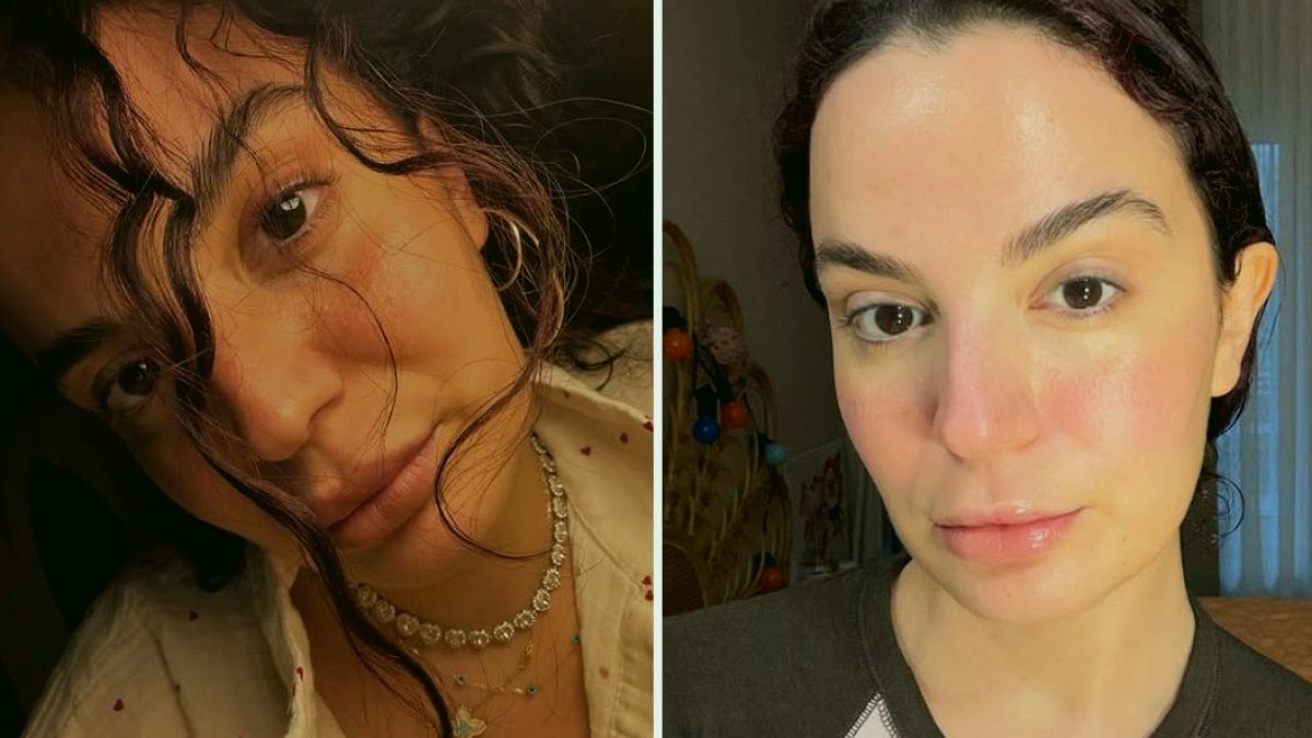 7 kez ameliyat oldu ama hastaneden yine çıkamadı