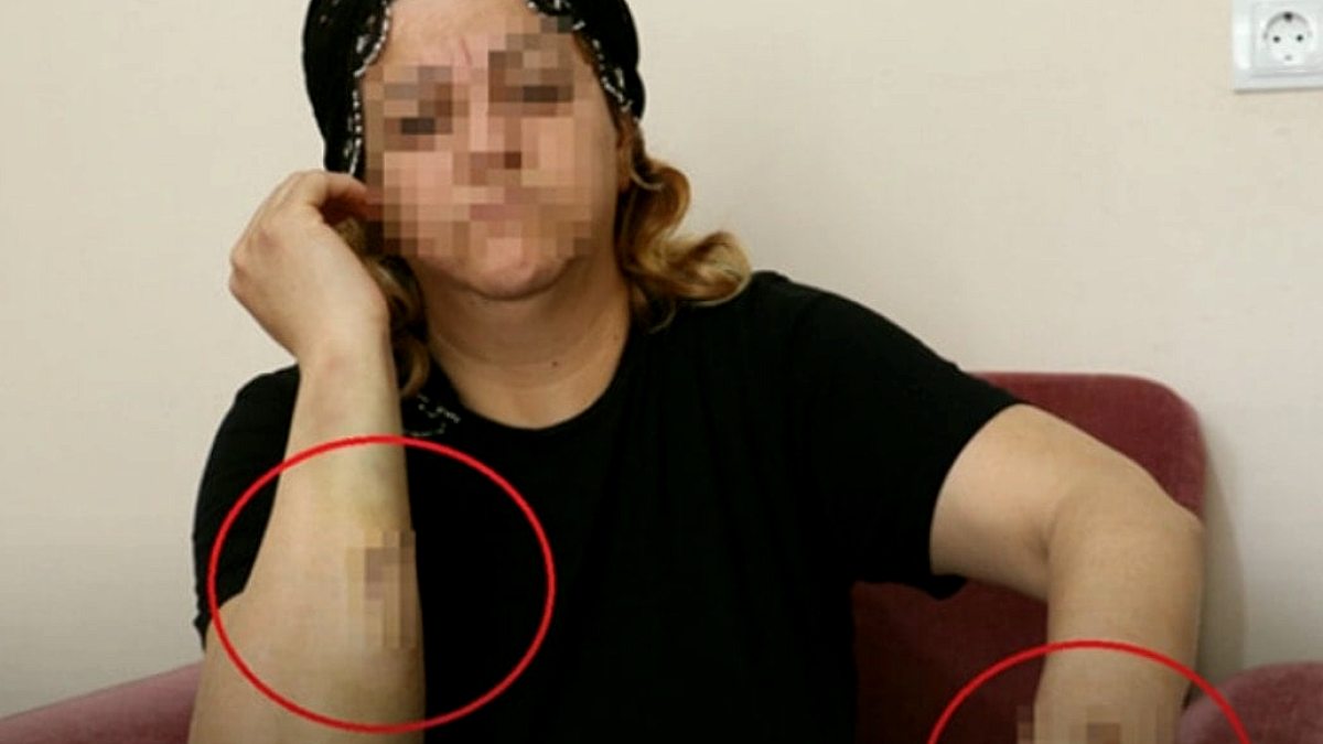 Diyarbakır’da kanlı pusu! Talihsiz kadını 30 yerinden bıçakladı