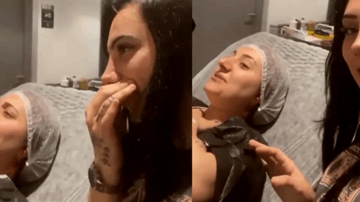 Gülerek girdiği burun ameliyatından çıkamadı