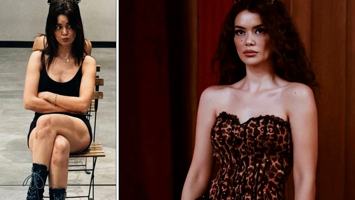 Direk dansı yaparken dizleri mosmor oldu: Oyuncu Seray Kaya o anları paylaştı